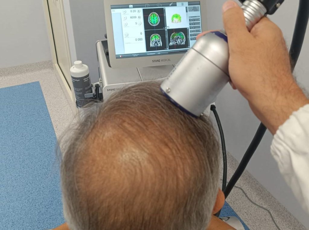 Alzheimer, al Maresca di Torre del Greco arriva l’ambulatorio per la stimolazione cerebrale
